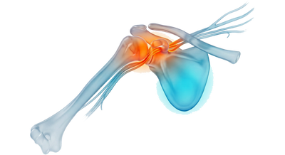 Clearance for Nerve Relief